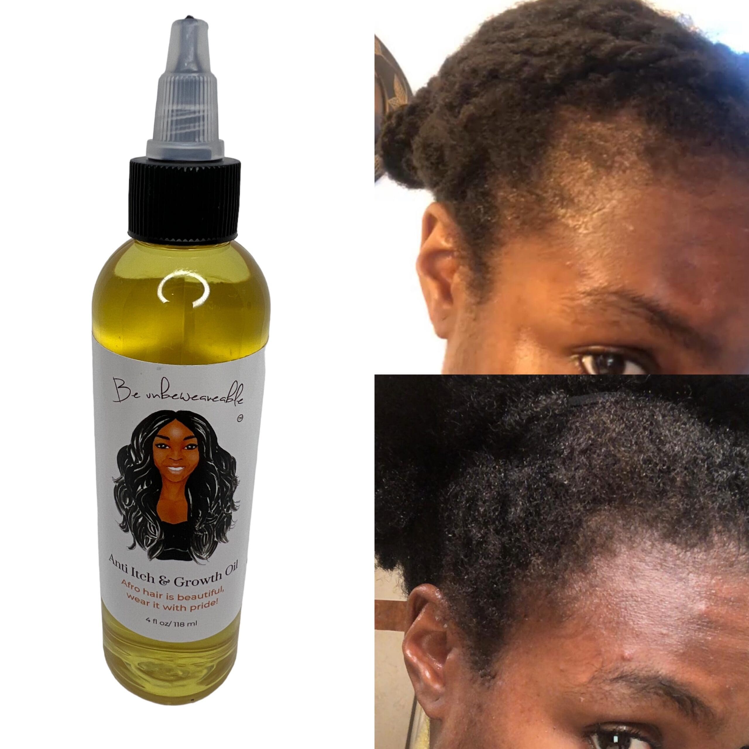 Anti Itch & Growth Oil- Black Hair Care 4C Afro,Curly,Coarse